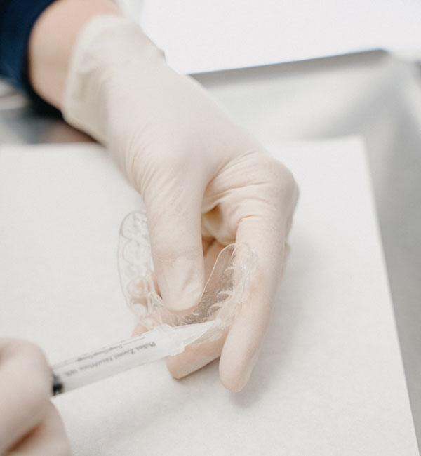 Befüllen einer Bleaching-Schiene für die Zahnaufhellung im MVZ Rage-Holm Bocholt