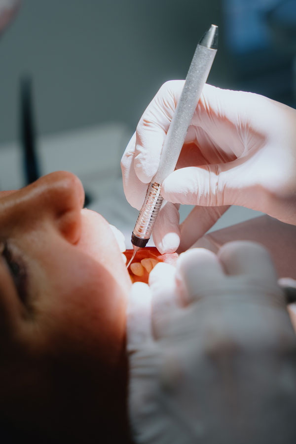 Zahnfleischbehandlung bei Parodontitis im MVZ Rage-Holm Bocholt