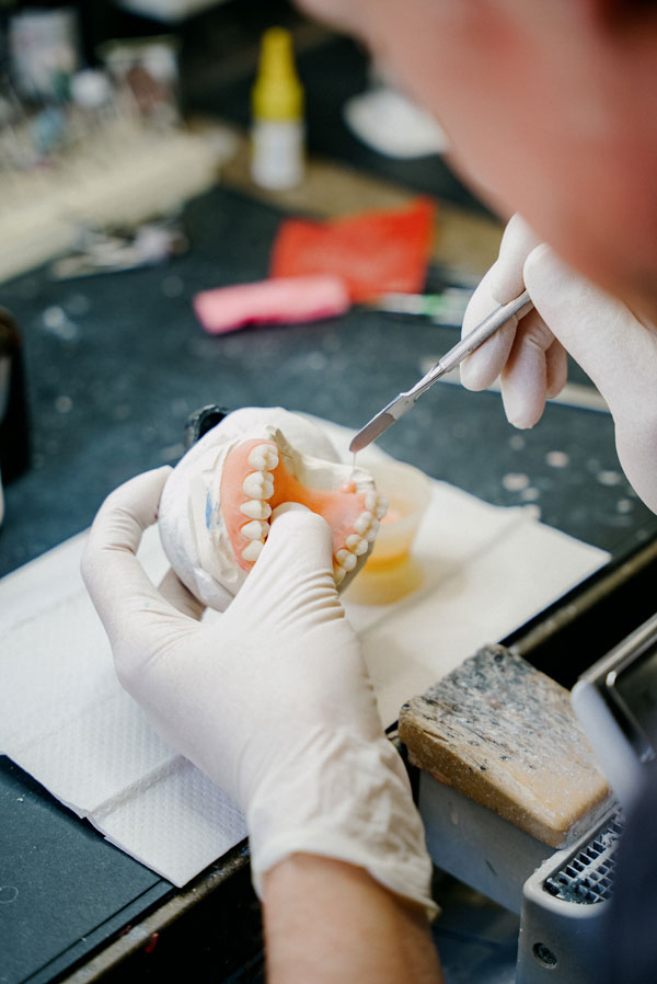 Anfertigung von Zahnersatz im zahntechnischen Meisterlabor des MVZ Rage-Holm Bocholt